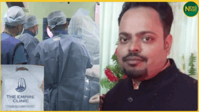 hair-transplant-death-kanpur-ae-vineet-dubey-case