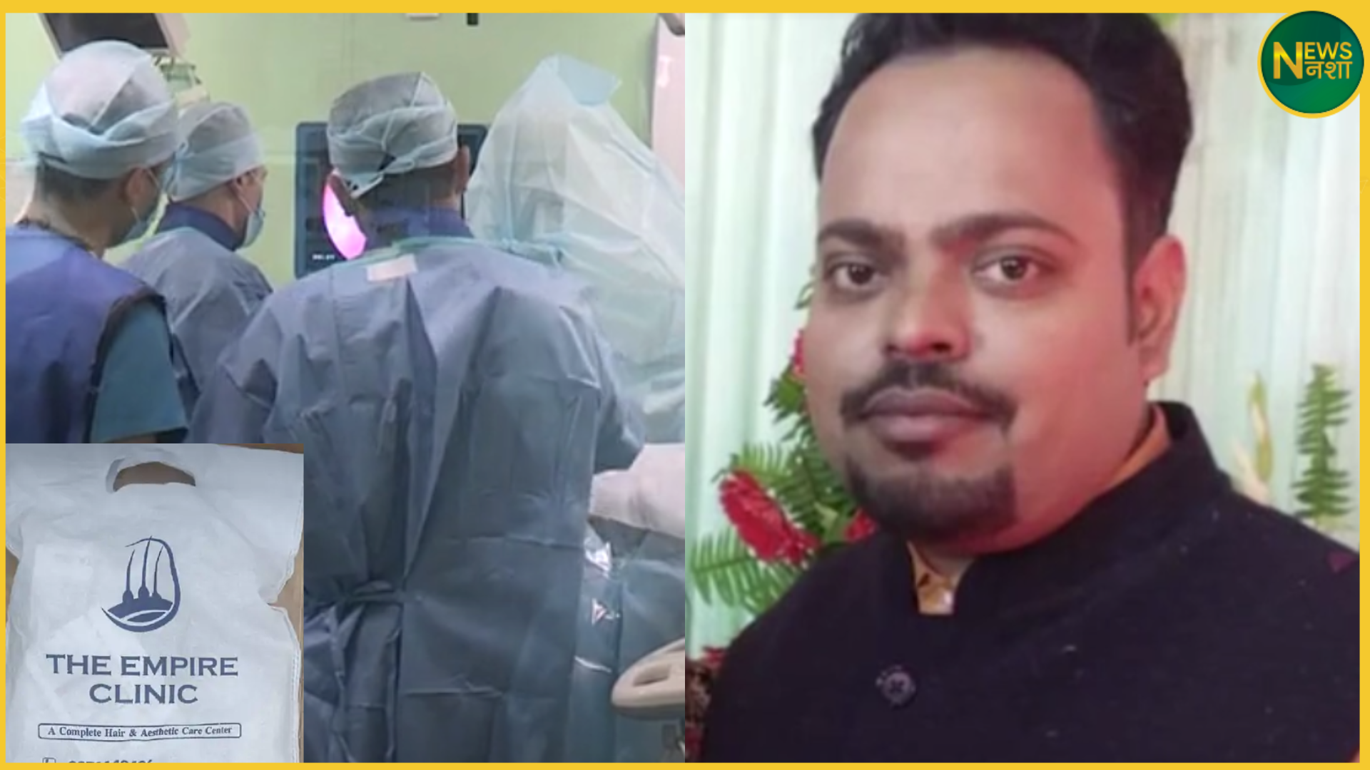 hair-transplant-death-kanpur-ae-vineet-dubey-case