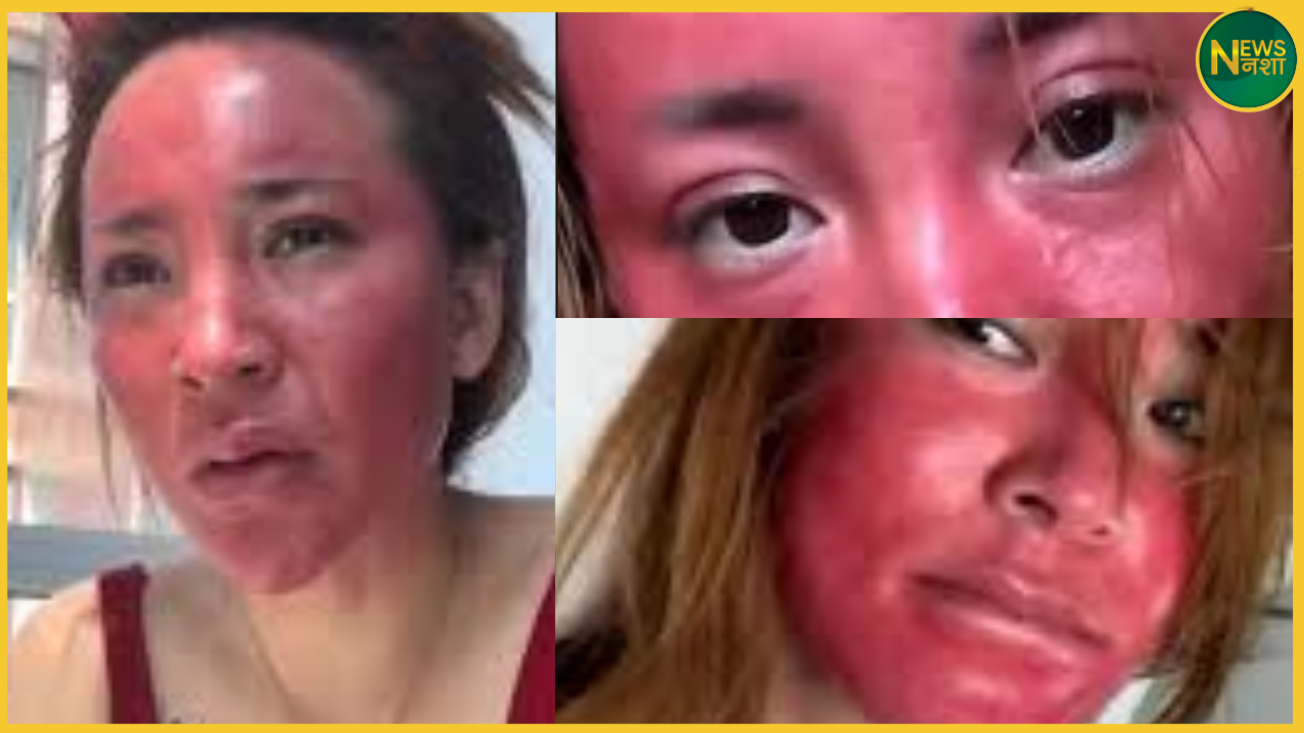 influencer-face-damaged-after-22-years-of-continuous-makeup
