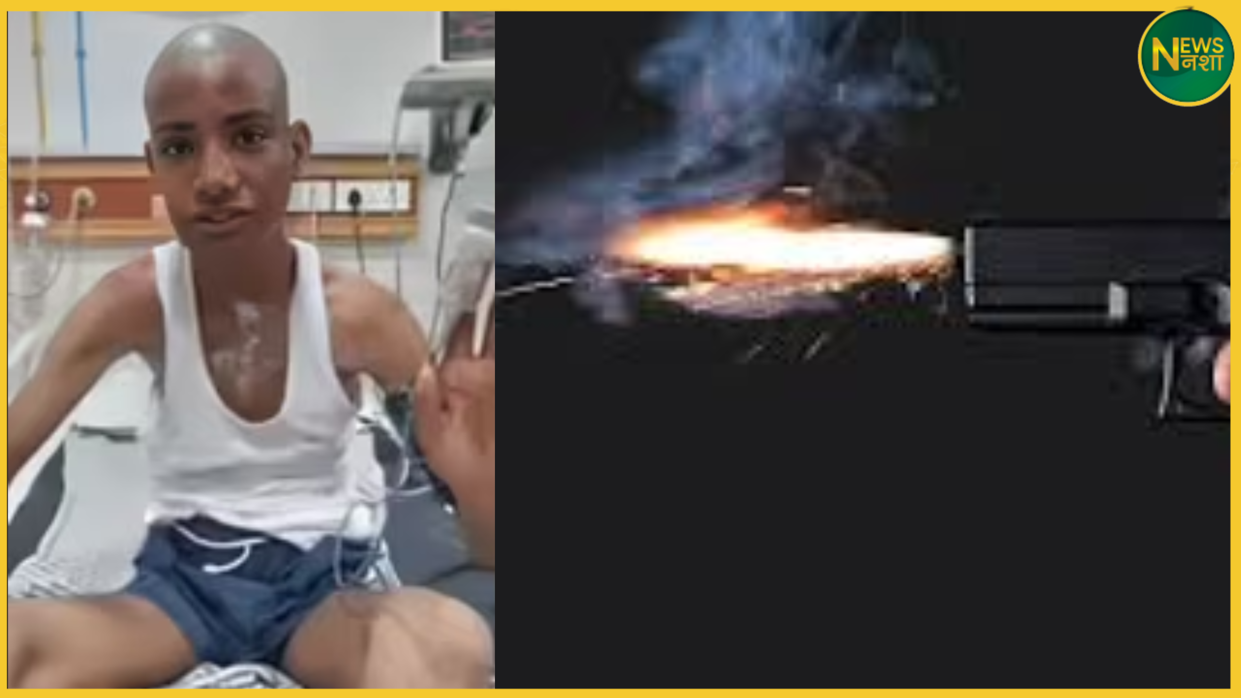 kota-boy-survives-bullet-through-skull-ear