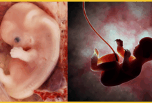 bhu-varanasi-me-foetal-autopsy-suvitha-shuru-hogi
