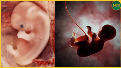 bhu-varanasi-me-foetal-autopsy-suvitha-shuru-hogi