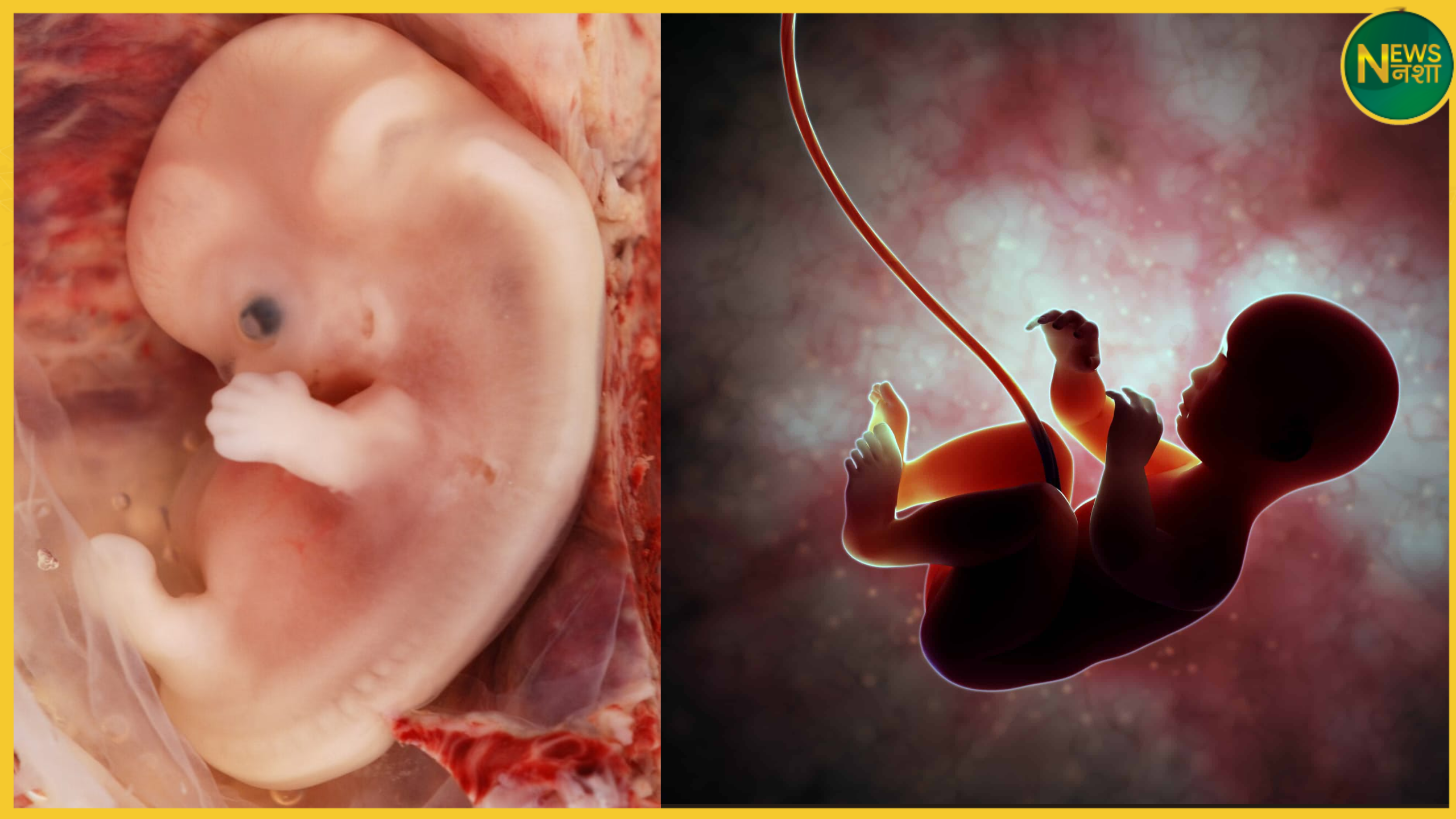 bhu-varanasi-me-foetal-autopsy-suvitha-shuru-hogi