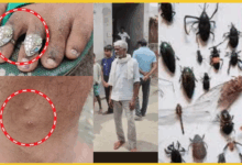 uttarpradesh/aligarh-r mysterious-insect-attack