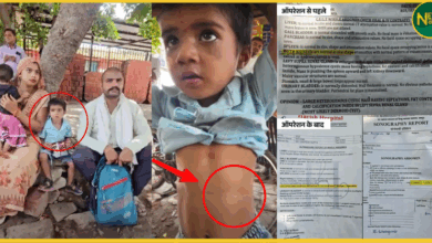 3-year-old-kidney-removed-during-surgery-mathura-hospital-case