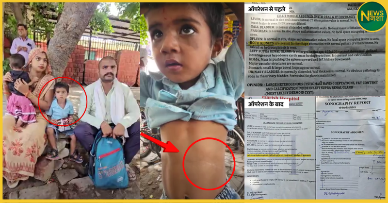 3-year-old-kidney-removed-during-surgery-mathura-hospital-case